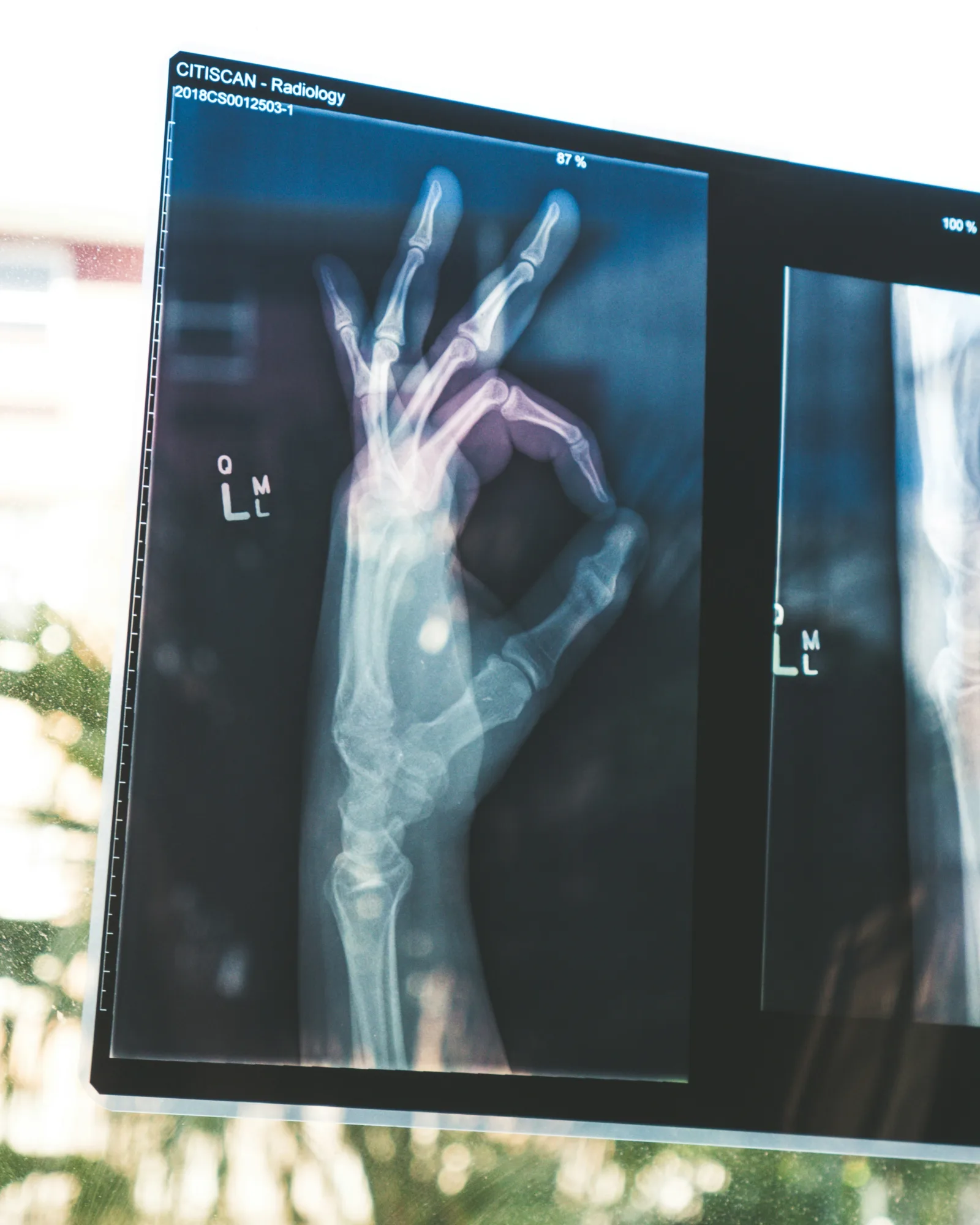 Information security in healthcare at Triade Information security in healthcare at Triade