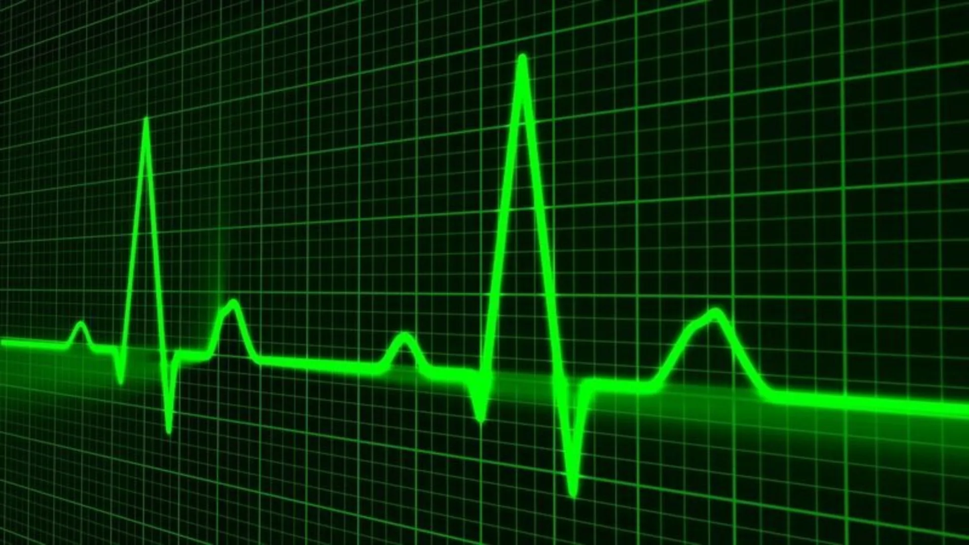 Pulse trace 163708 1280 width 800 placeholder